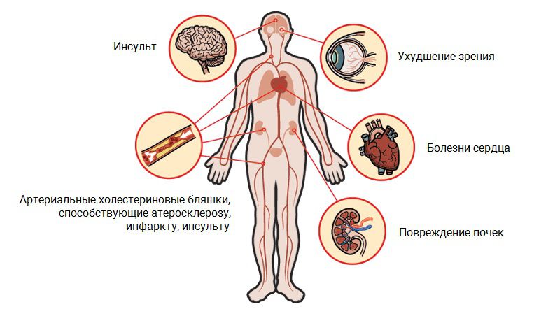 Риски гипертонии