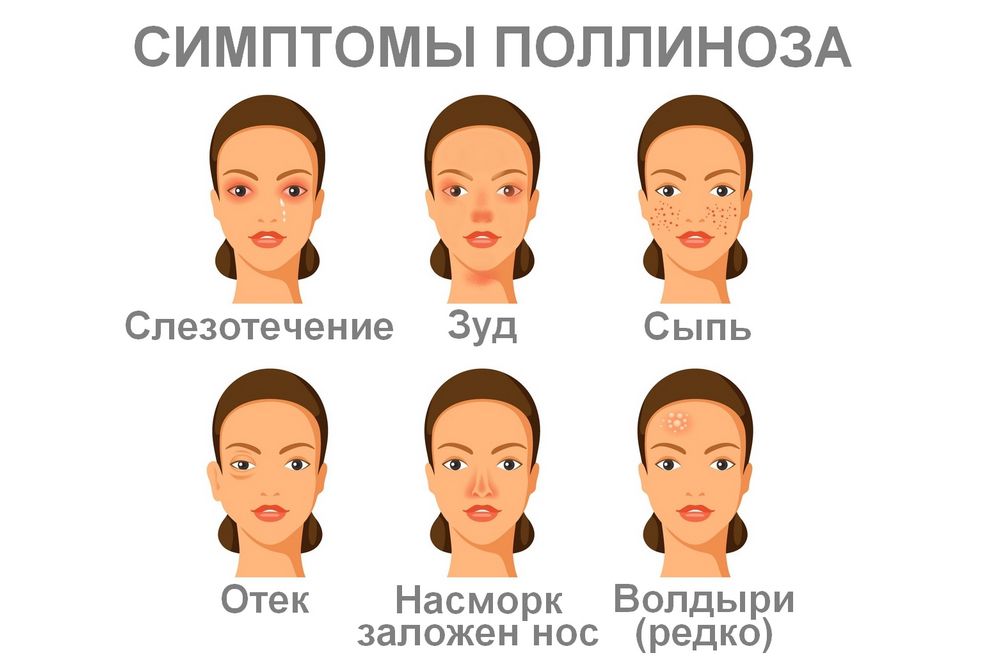 Симптомы аллергии
