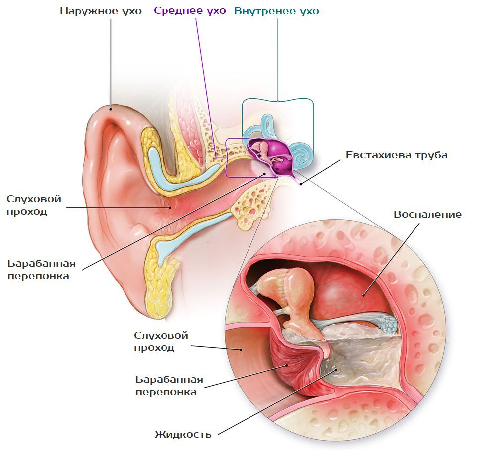 Строение уха и отит (на примере среднего отита)